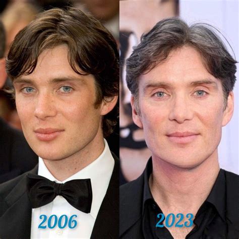 cillian murphy plastic surgery|cillian murphy transformation.